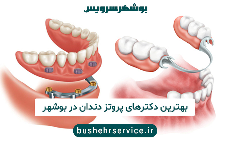 پروتز دندان