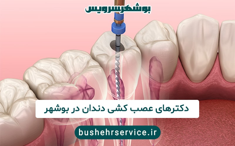 دکترهای عصب کشی دندان در بوشهر