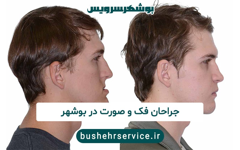 جراحان فک وصورت در بوشهر